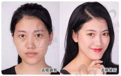 与新乡其他整形机构对比