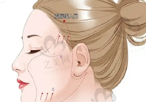 北海华美整形美容门诊部是否靠谱