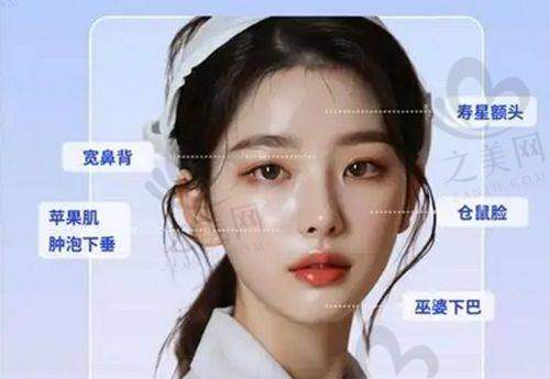 双眼皮手术项目及价格
