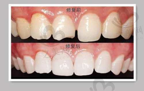 北京瑞泰口腔医院的价格与其他医院对比情况