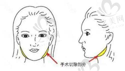 北海博铧整形医院与当地其他医院的对比