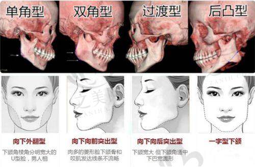 连锁与资质优势