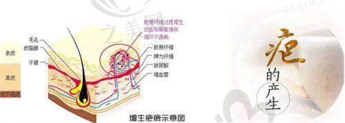 扬州隆胸医院排名中的雷医生门诊部