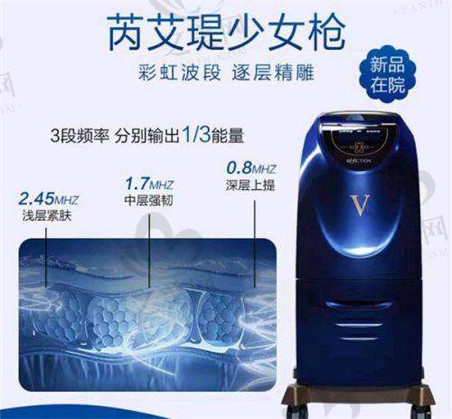 项目种类