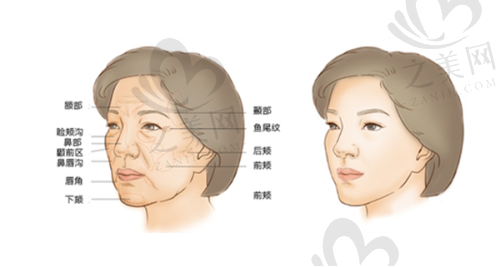 值得信赖的选择