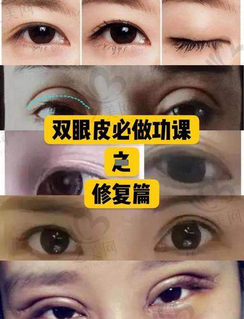 欧阳帆医生手术价格与适合人群