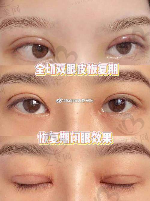 深圳宝丽医疗美容仅南山有一家不是连锁,资质正规可查,鼻修复满意度95%技术口碑排top3