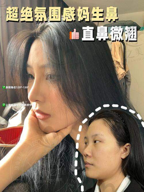选择正规医院做鼻子的重要性