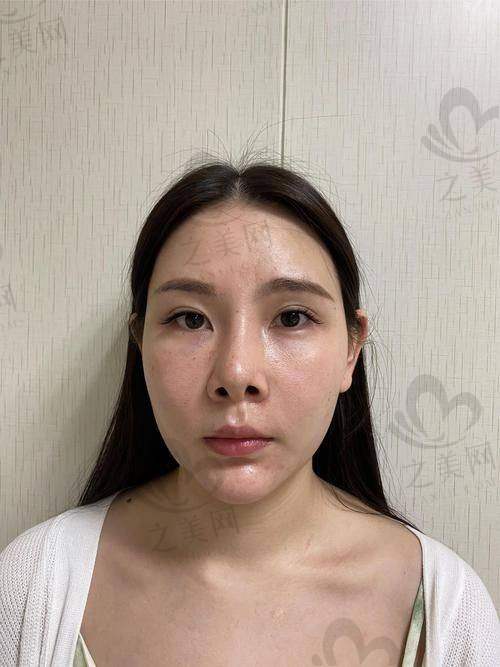 沈阳整鼻子医生推荐