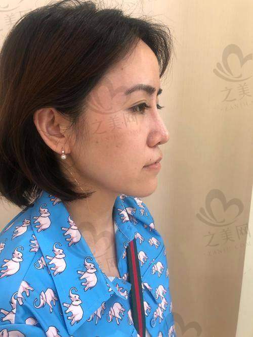 沈阳做鼻子好的医院推荐
