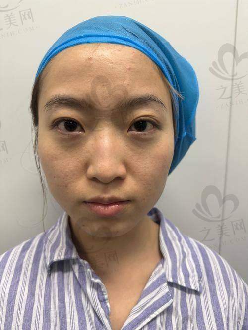 不做手术的应对方法