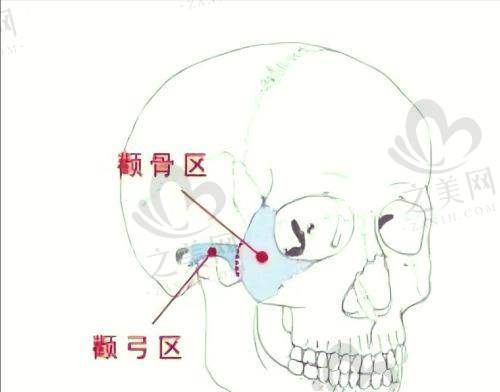 影响深圳下颚线整形价格的因素