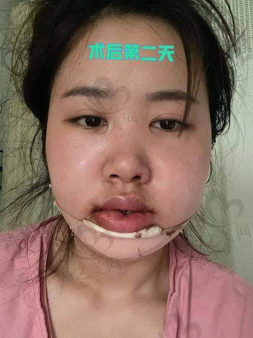 医院整形口碑情况