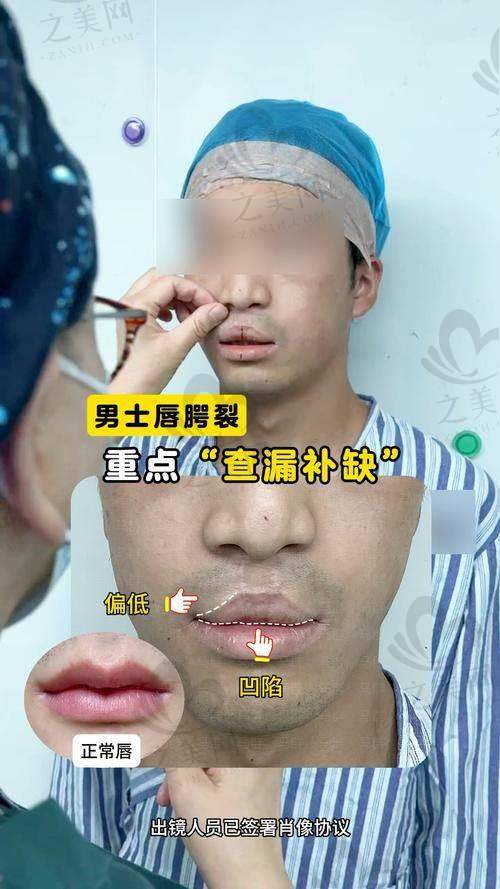 汕头市中 心医院整形烧伤科和手外科优势