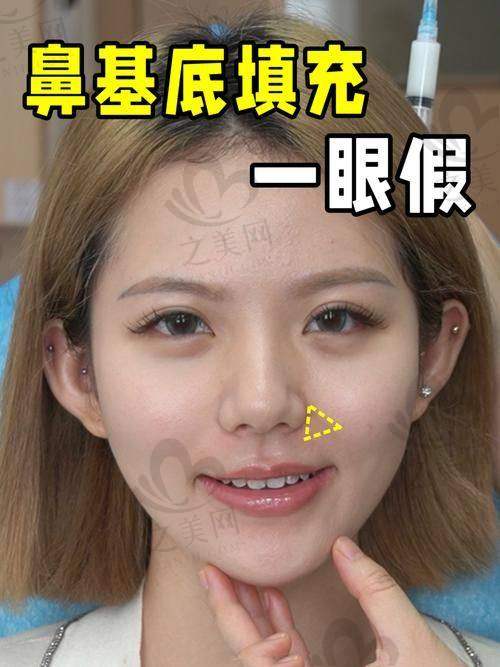 厦门脸博士整形外科价格与特点