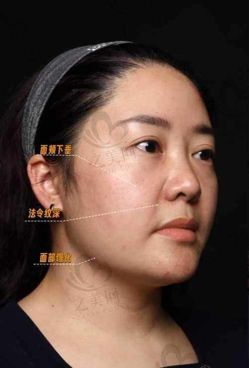 成都娇点医学美容医院——姜宇禄医生