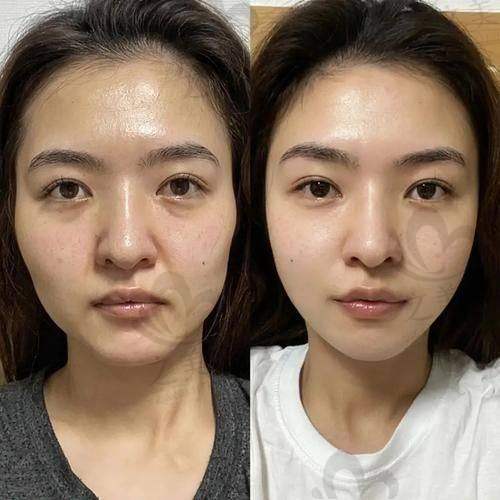 成都铜雀台医学美容医院——雷刚医生