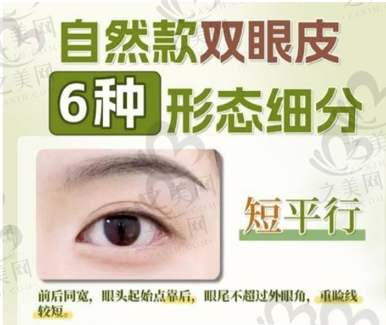 2024眼整形医生佀同帅坐诊上海华美医院,擅长显微双眼皮,附预约方式及手术价格