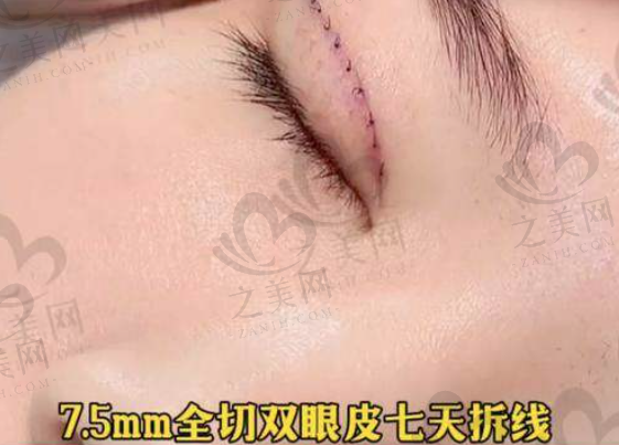 2025眼整形医生魏志香在北京知音和晶美坐诊,附出诊时间、项目价格及预约挂号方式