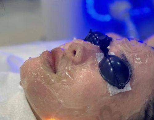影响重庆市中医院光子嫩肤价格的因素