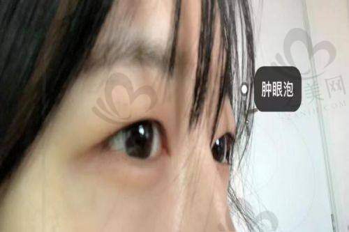 林靖医生收费价格