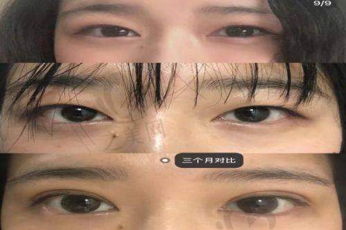 林靖医生擅长项目