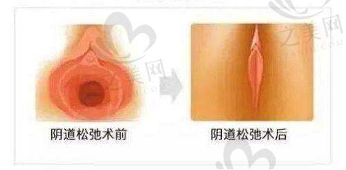 南京激光祛斑价格区间分析