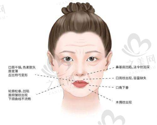 影响打唇珠费用的因素