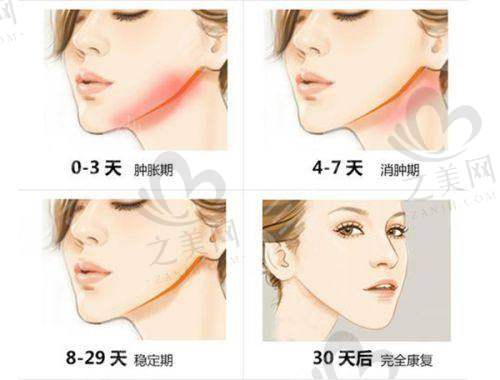 口碑评价