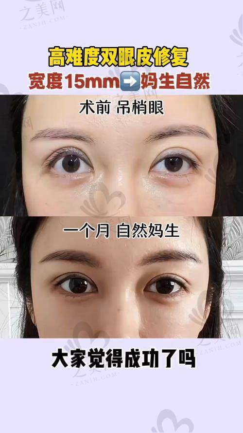 林靖医生技术优势