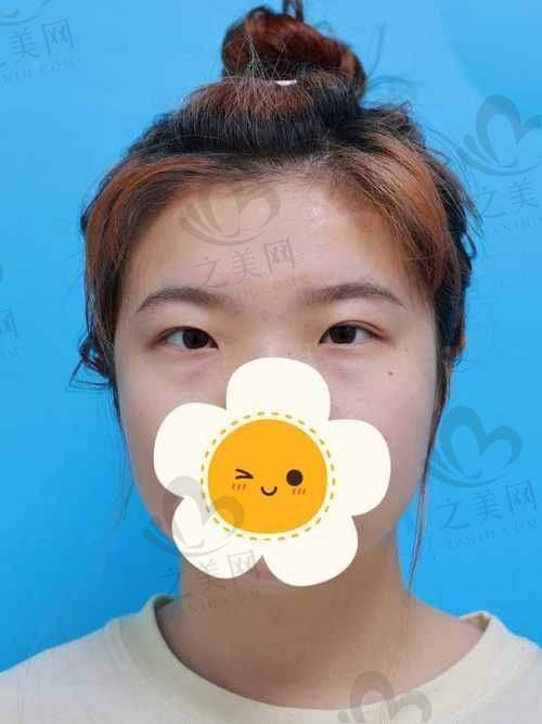 北京知音医疗美容门诊部预约挂号方式