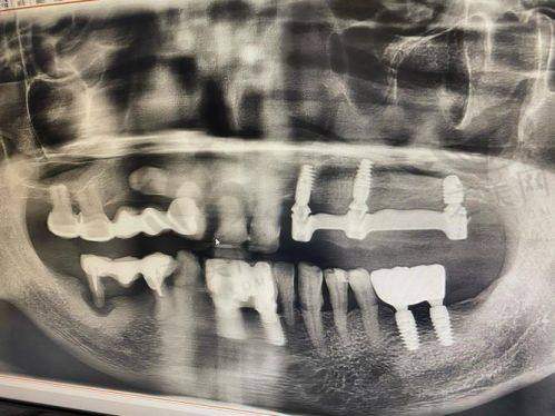 嘉兴看牙犯难?十大正规口碑好的口腔科汇总来了,嘉诚、牙博士等各有亮点!