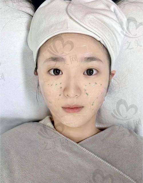光子嫩肤注意事项