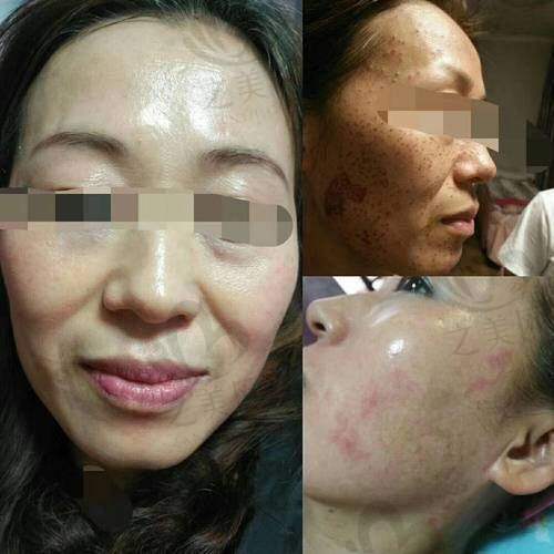 专精医生操作保护成效