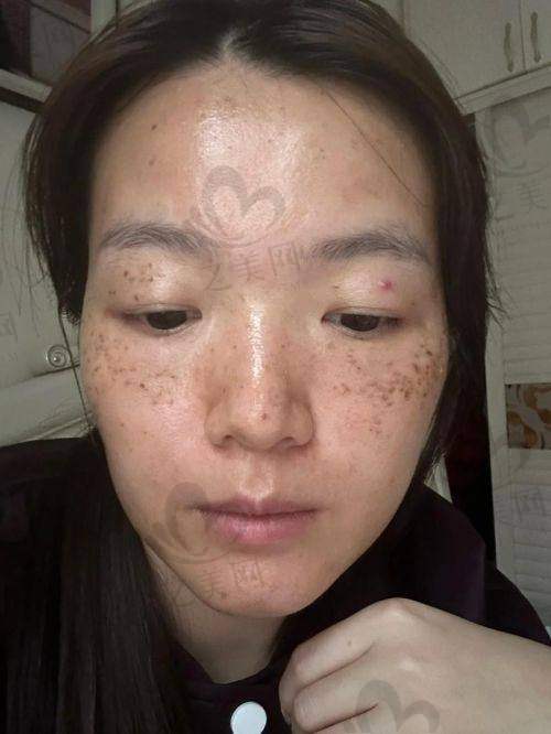医院方面对价格的影响