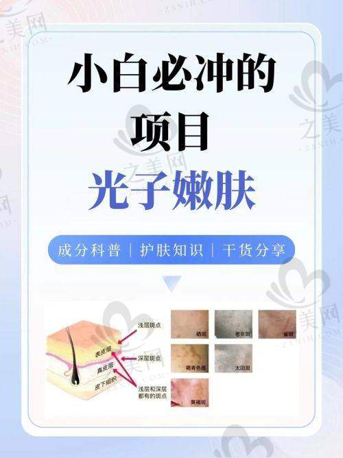 北京协和医院光子嫩肤的成功实例