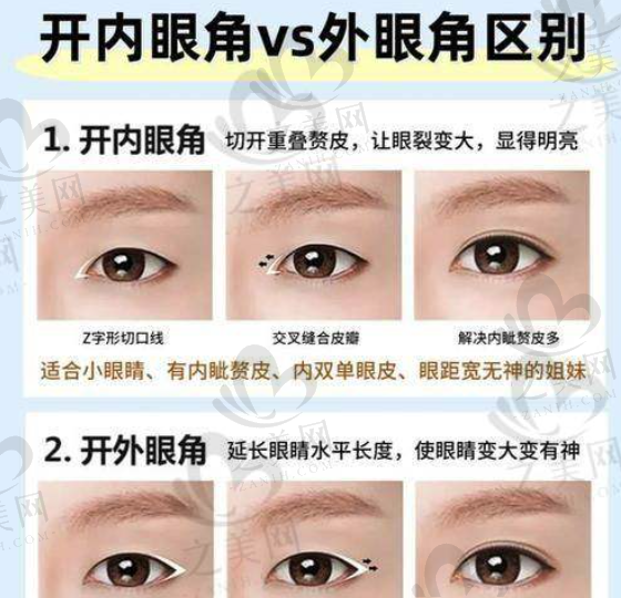 上海黄浦区开眼角医院推荐:上海时光/华美/美莱/伯思立/艺星2025年正规排行榜及费用一览