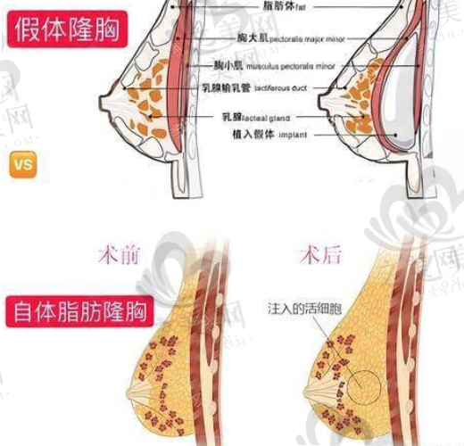 想做男性胸部整形?这里有整形医生推荐和排名,杭州美莱栗勇院长20年临床经验别错过