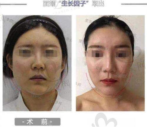 其他整形项目推荐