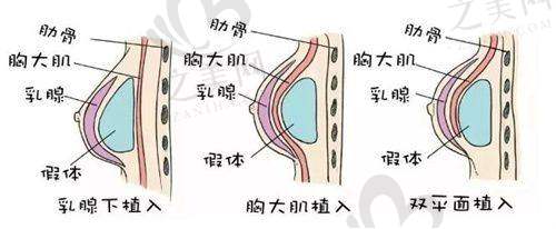 南京艺星医疗美容医院预约价格表