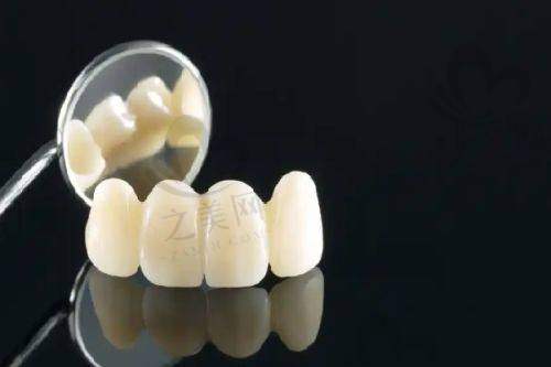 熙直美种植体的质量分析