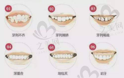 横向对比与就诊建议