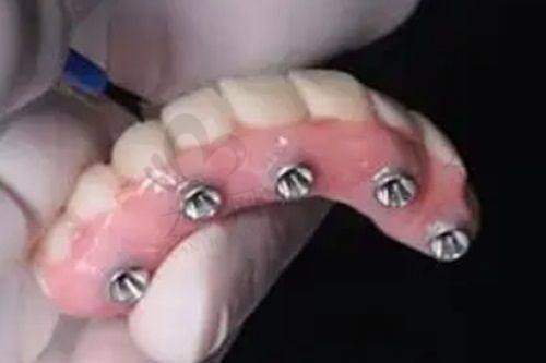 诊疗操作规范