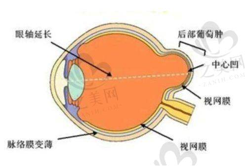 郑州华厦视光眼科医院:全飞秒技术强者