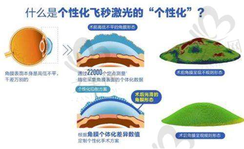 南京儿童眼科好的医院排名