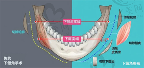 康美整形医院——口碑出众