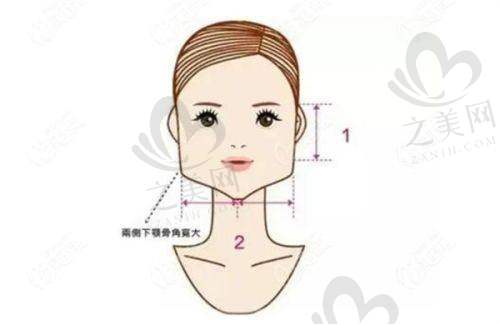 一、上海黄浦区拉皮手术的基本概述