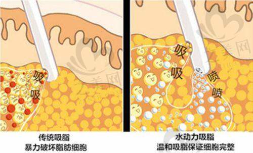 杨亚益眼修复揭秘
