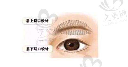 整形医生李晓东是哪个医院的?他目前在北京黄寺整形美容医院任职,PST面部提升术技术好