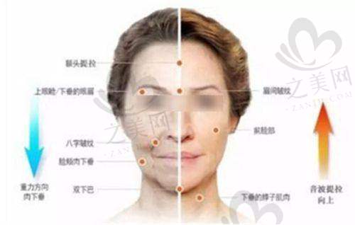 乌鲁木齐面部线提升与微整形选择建议